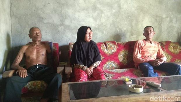 Nelangsa Fitri, Gadis Lamongan yang 17 Tahun Matanya Tertutup Tumor