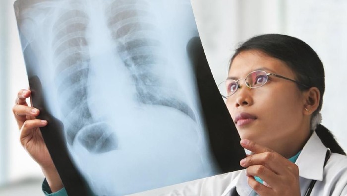 Pneumonia Misterius Gemparkan China, Ini Imbauan Kemenkes RI