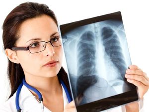 Pneumonia Vs Paru-paru Basah, Sama atau Beda? Ini Kata Dokter