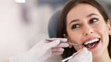 Veneer Gigi Berakhir Bencana, Wajah Wanita Ini Malah Jadi Lumpuh Sebelah