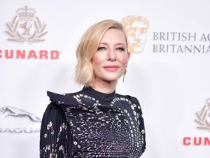 Duh, Kepala Cate Blanchett Terluka Saat Gunakan Gergaji