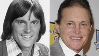 Dan tentunya Bruce Jenner yang tak hanya mengubah wajahnya tapi juga ingin mengganti kelaminnya itu dan tampil menjadi wanita dengan nama Caitlyn Jenner. Dok. Ist