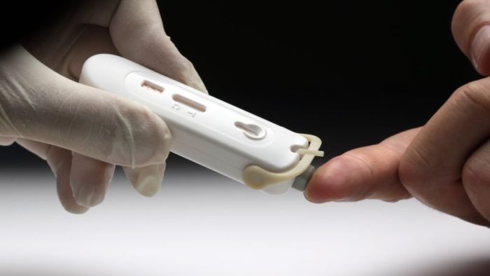 Australia Izinkan Alat Tes HIV Sendiri yang Bisa Dibeli Online