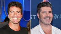 Simon Cowell secara terbuka sempat mengatakan dirinya melakukan suntik botox dan ia menyesalinya dan mengatakan bahwa itu ternyata berlebihan. Foto: Dok. Ist