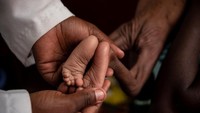 Selain memiliki risiko kematian yang cukup tinggi, kekurangan gizi kronis juga dapat berdampak pada kesehatan fisik dan mental jangka panjang anak-anak di Republik Asia Tengah. UNICEF/Ashley Gilbertson/VII Photo/Via Reuters.