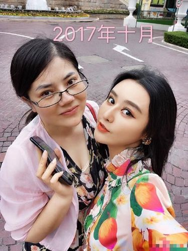 Viral Foto Dua Wanita yang Operasi Plastik Mirip Artis Ini Bikin Bingung Netizen