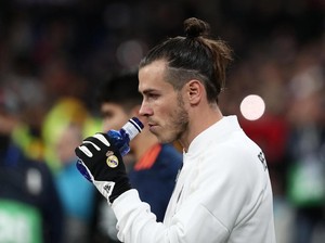 Cedera Bale Tidak Serius, Kok...