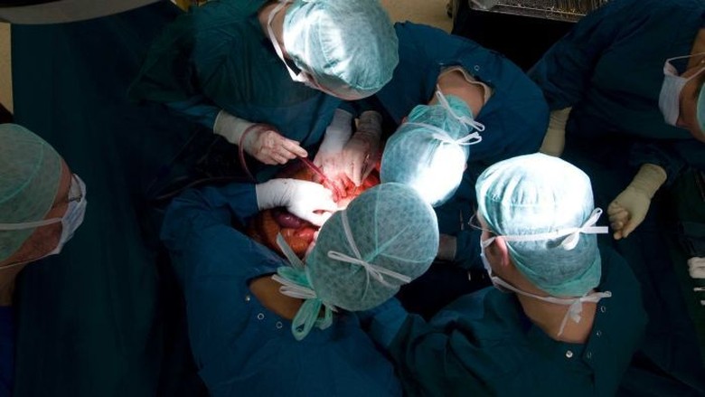 Ribuan Warga Australia Berkontribusi pada Perdagangan Organ Tubuh Ilegal Ribuan Warga Australia Berkontribusi pada Perdagangan Organ Tubuh Ilegal