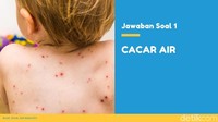 Ada yang bisa jawab benar? (Foto: detikHealth) 