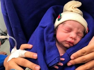Pertama Kali, Bayi Lahir dari Transplantasi Kandungan Donor yang Meninggal