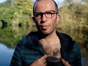 Peretasbio: Orang-orang yang Meretas Tubuh Mereka Sendiri