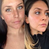 Viral, Foto Wanita yang Jadi Bukti Pentingnya Pakai Pelembap dan Sunscreen