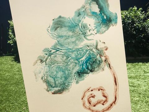 Kisah Bidan yang Raup Penghasilan Rp 156 Juta dari Jualan Plasenta