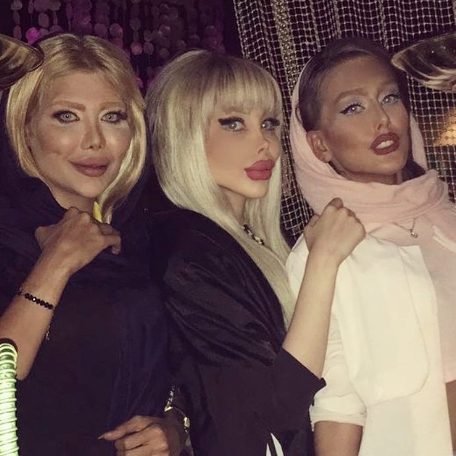 Sananztt punya teman-teman yang penampilannya tak kalah ekstrem. Para wanita ini juga tampak melakukan operasi plastik. Foto: Instagram (@Sanaztt)