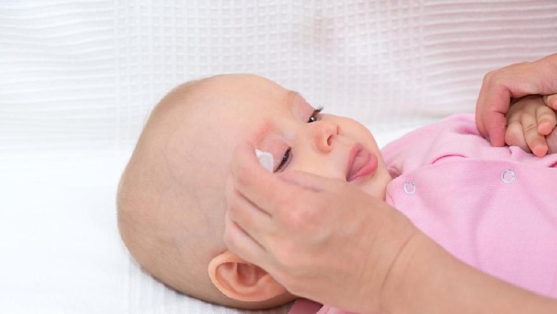 Mengobati mata bayi belekan/ Foto: iStock Mengobati mata bayi belekan/ Foto: iStock