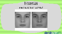 Kira-kira dua wajah ini milik siapa? (Foto: detikHealth)