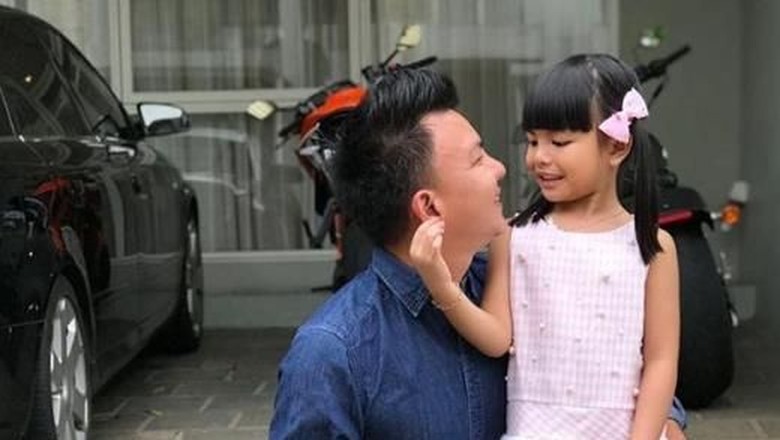 Jerry Aurum Sebut Shakira Tetap Tersenyum Meski Pipi Bengkak
