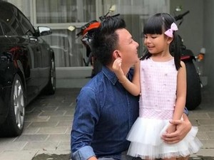 Jerry Aurum Sebut Shakira Tetap Tersenyum Meski Pipi Bengkak