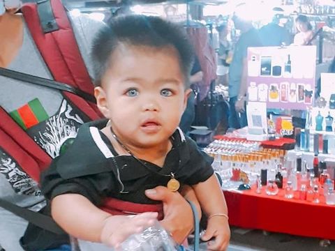 Bocah ini viral karena bola matanya berwarna biru.