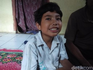 Bocah Bandung Bersuara Trompet Usai Peluit Tertelan