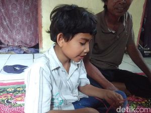 Dokter Keluarkan Peluit yang 2 Bulan Bersarang di Tubuh Asep