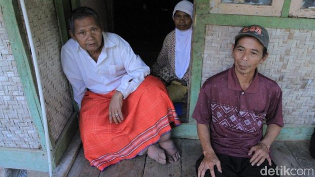 Sakit Kaki Gajah  Warga Sumedang Butuh Pengobatan dan Rutilahu