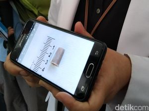 Benda-Benda Berbahaya yang Sering Tertelan, Peluit Hingga Gigi Palsu (2)