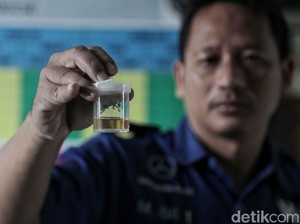 Antara Jijik dan Kagum, Minum Urine Sendiri Demi Kesehatan