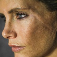 Olivia pun mengalami kecelakaan ketika syuting. Dilansir Dailymail, wanita 37 tahun tersebut terpental dari motor setelah bagian atas tubuhnya menabrak kamera mobile. Kecelakaan tersebut merusak wajahnya hingga menyebabkan tangan Olivia harus diamputasi. Saat itu, ia tidak memakai helm. Foto: Instagram @olivia_stunts