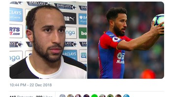 Gol Townsend disebut tak kalah apik dari hasil transplantasi rambutnya. (Foto: Internet/Twitter)