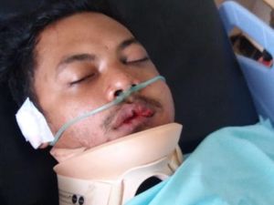 Krisna Adi, yang Dihukum Seumur Hidup oleh PSSI, Kecelakaan di Sleman