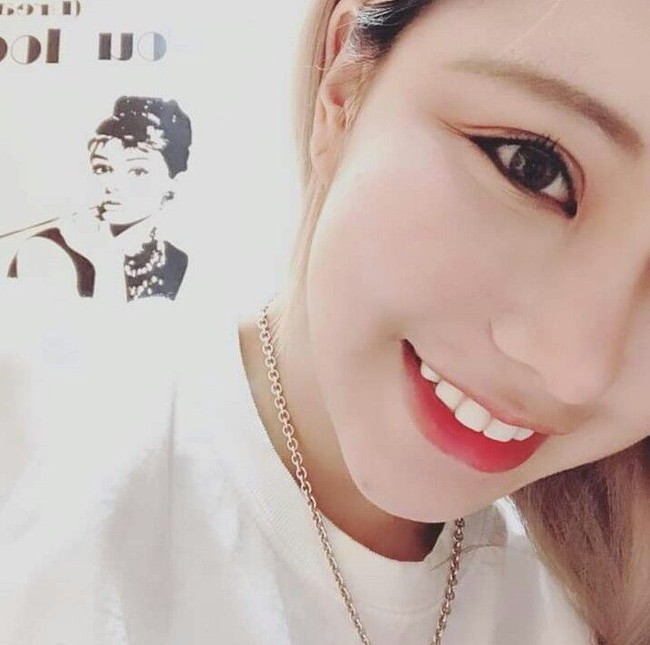 Ia terus merombak diri untuk mendapatkan satu pujian. Setelah melakukan 30 operasi plastik, Berry pun tetap tidak mendapatkan pujian justru terus dikritik dan membandingkannya dengan wanita lain. Pada saat itu jika dia menghentikanku dan memujiku aku cukup cantik, aku akan berhenti dan tidak melakukannya lagi, curhatnya di videonya di Facebook pada 2017 silam. Foto: Dok. Instagram