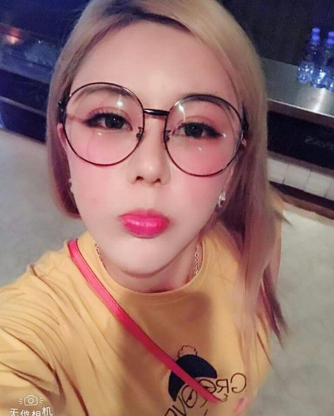 Diakuinya, ia melakukan tindakan ekstrem itu demi kekasihnya. Berry yang memiliki kepercayaan diri yang rendah mengaku kerap mendapatkan kritikan penampilan dari sang pacar. Foto: Dok. Instagram