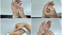 Sakit punggung yang disebabkan karena duduk terlalu lama tentu sangat mengganggu. Kamu mungkin akan melakukan apa saja untuk meringankannya. Daripada minum obat, tidak ada salahnya melakukan pijatan ringan di tangan. (Foto: detikHealth)