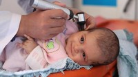 Fatima, seorang balita berusia tiga bulan tengah diperiksa di klinik keliling di Suriah. Fatima terlihat tetap tersenyum. Klinik keliling dan petugas kesehatan menyediakan layanan perawatan untuk anak-anak. Klinik tersebut menyediakan nutrisi kepada hampir 1,9 juta anak, ibu hamil dan menyusui di Suriah. Istimewa/UNICEF/Al-Isla.