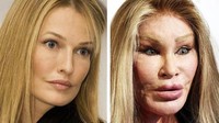 Jocelyn Wildenstein, miliarder yang terkenal boros menghabiskan US$ 4 juta untuk operasi wajah yang gagal. istimewa/ppcorn.