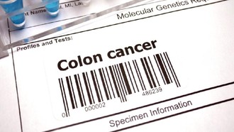 Kisah Wanita 24 Tahun Kena Kanker Usus Stadium 4, Ini Gejalanya