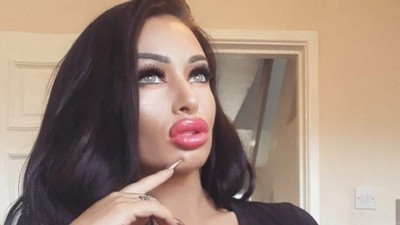 Penampilan Ava, Wanita yang Obsesi Implan Payudara Meski Kulit Hampir Robek