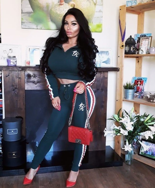 Tak peduli dengan kondisinya saat ini, model Irlandia Ava Van Rose bersikeras untuk melakukan operasi plastik untuk memperbesar payudaranya. Dalam reality show tentang operasi plastik berjudul Bothced, wanita 26 tahun itu mengatakan bahwa kulit dadanya sudah hampir robek karena payudaranya yang kini sudah terlalu besar. Foto: dok. Instagram (@avavanroseofficial_)