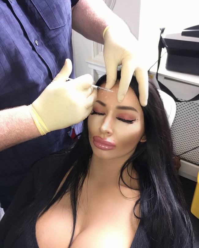 Inilah momen saat Ava melakukan botox di wajahnya. Tak sedikit netizen yang nyinyir dengan penampilannya yang terlihat palsu. Sejumlah netizen menilai wajahnya terlalu kaku karena efek botox terlalu banyak. Foto: dok. Instagram (@avavanroseofficial_)