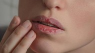 4 Kebiasaan Ini Penyebab Bibir Kering dan Pecah-pecah Saat Puasa