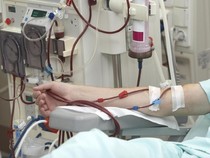 Umur 15 Tahun Sudah Cuci Darah, Kenapa Minuman Manis Bikin Gagal Ginjal?