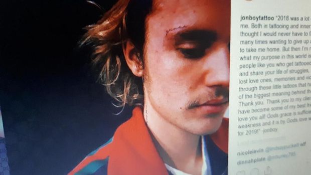 Tanda Cinta untuk Hailey, Justin Bieber Bikin Tato di Alis