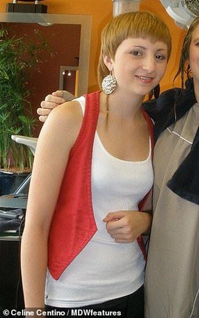 Beginilah penampilan Celine Centino di masa lalu. Ia tampil dengan kawat gigi. Celine remaja pun kerap menerima bully. Ia diejek jelek hingga gemuk. Foto: Celine Centino. dok. Celine Contino