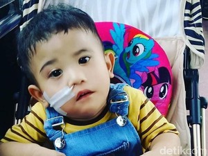 Semangat Adelio, Bocah Pengidap Poland Syndrome Pertama di Indonesia