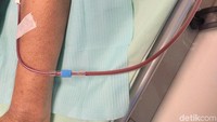 Darah pasien diambil dan dialirkan melalui selang dengan tube yang berwarna merah. (Foto: Khadijah Nur Azizah/detikHealth)  