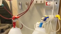 Demudian di antara serat serabut pada dialiser terdapat cairan dialisat. Namanya bikarbonat dan acid serta air RO sebagai komponen cuci darah. (Foto: Khadijah Nur Azizah/detikHealth)