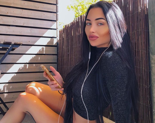 Ini Celine Centino, wanita asal Zurich, Swiss yang jadi korban bully saat remaja. Ia melakukan balas dendam dengan mempercantik diri lewat operasi plastik. Foto before-afternya mengejutkan. Foto: Instagram (ccentino)