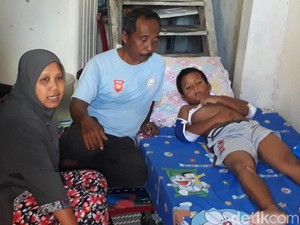 Plt Walkot Cilegon Selidiki Kasus Korban Tsunami Ditagih RS Rp 17 Juta