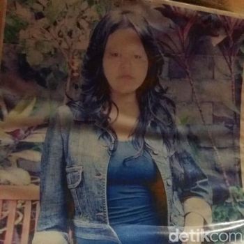 Fakta-fakta Titin Wanita Berbobot 350 Kg Asal Kalteng